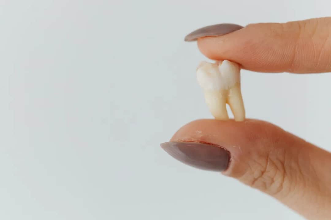 Co dentysta robi z wyrwanym zębem? Ważne informacje o utylizacji