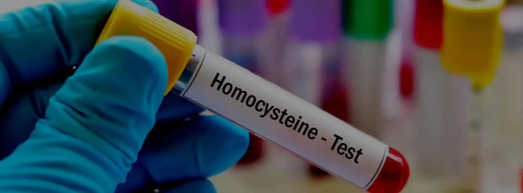 Ile kosztuje badanie homocysteina? Sprawdź ceny i oszczędź pieniądze