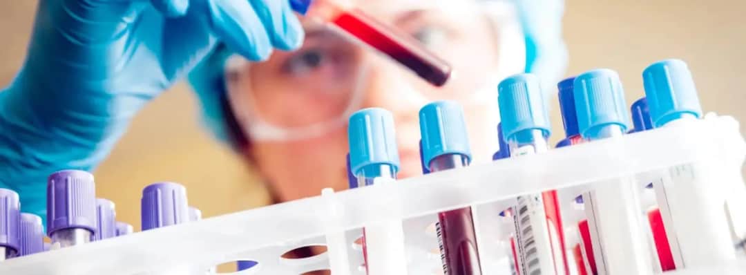 Jakie są badania z krwi? Poznaj ich znaczenie dla zdrowia
